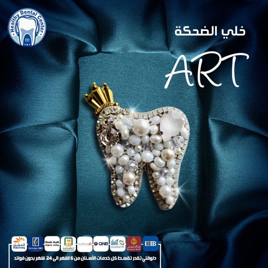زراعة اسنان بالتقسيط