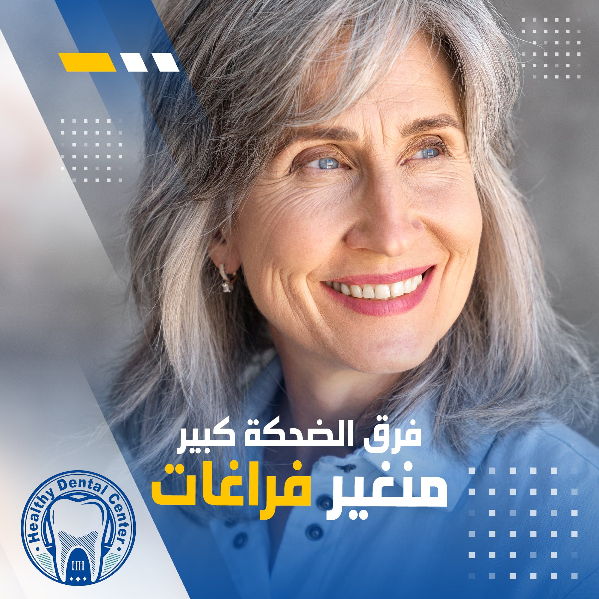 تقويم الاسنان التجميلي
